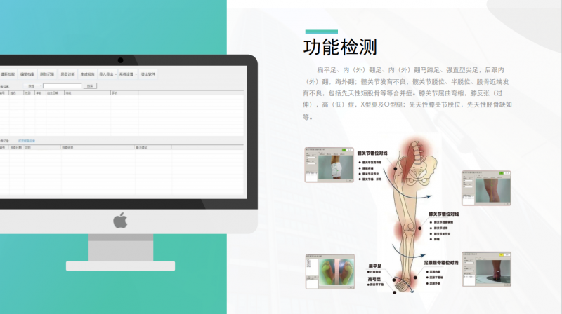 下肢關(guān)節(jié)對(duì)線及足底壓力分布檢測(cè)設(shè)備-