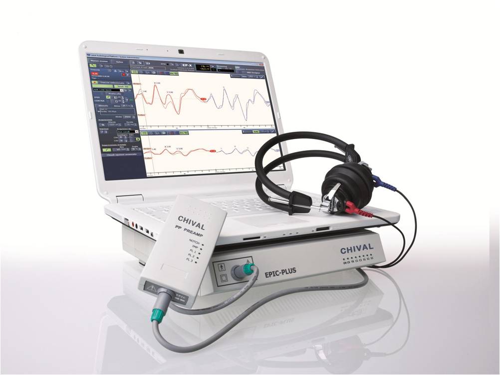 多頻耳聲腦干誘發(fā)電位測試