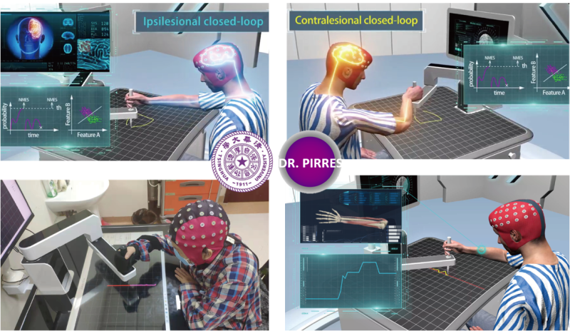 智能精準(zhǔn)康復(fù)機(jī)器人專家系統(tǒng)-