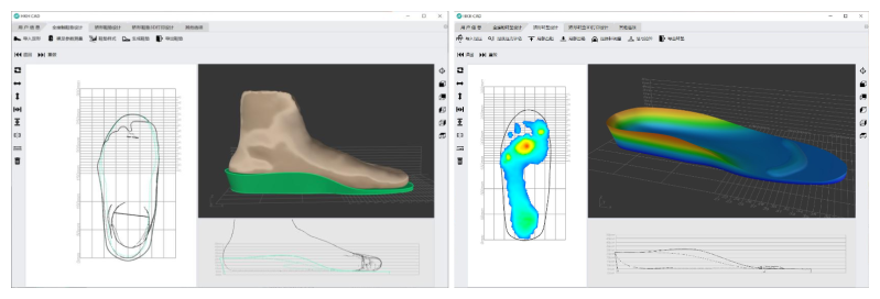 矯形鞋墊快速設(shè)計(jì)軟件-
